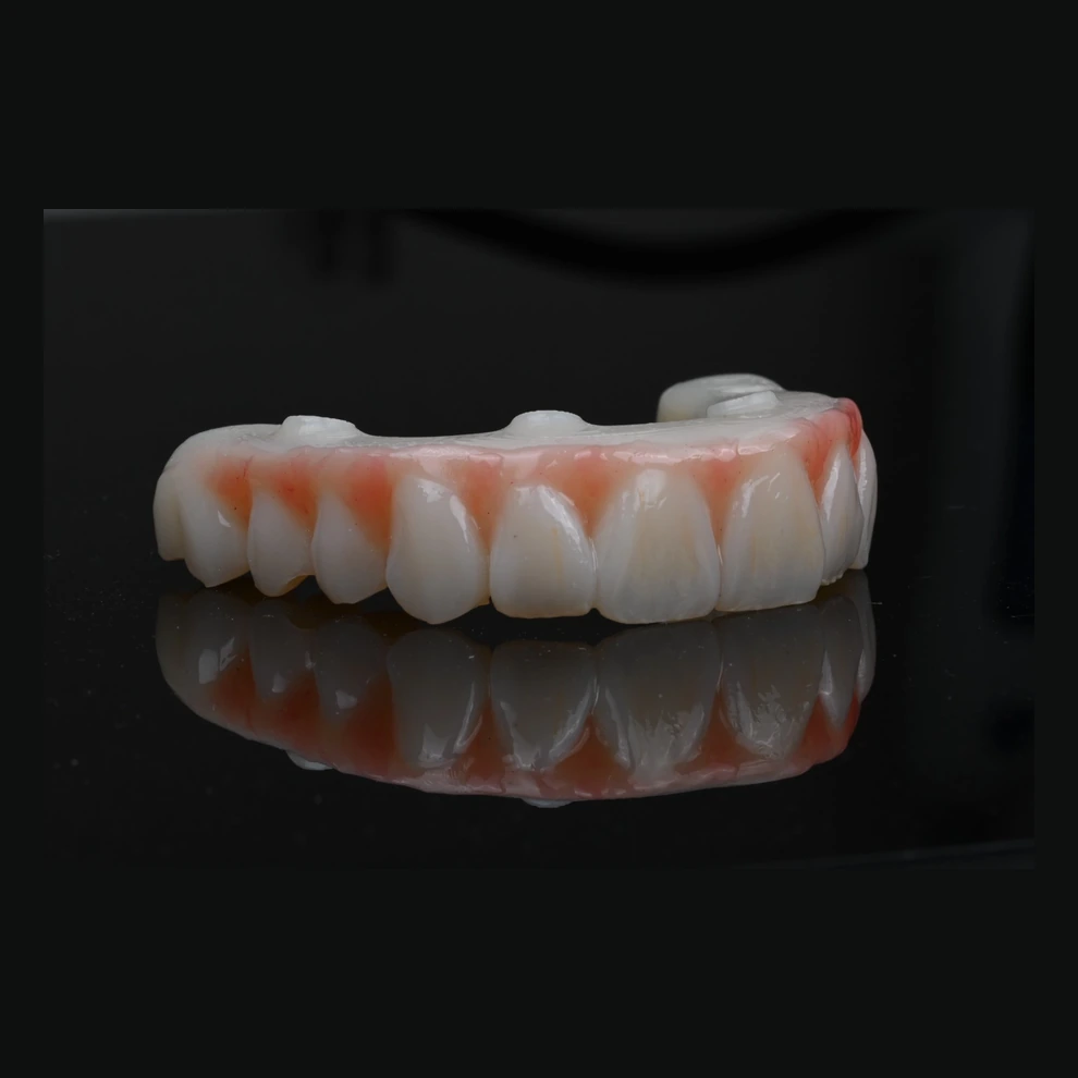 Fixed hybrid denture printed with NanoCeram